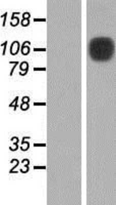 Western Blot: DDR1 Overexpression Lysate (Adult Normal) [NBP2-07401] Left-Empty vector transfected control cell lysate (HEK293 cell lysate); Right -Over-expression Lysate for DDR1.