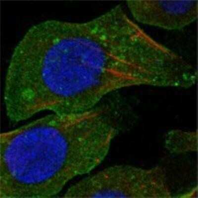 Immunocytochemistry/Immunofluorescence: DDR2 Antibody (3B11E4) [NBP1-28883] - Analysis of A549 cells using DDR2 mouse mAb (green). Red: Actin filaments have been labeled with DY-554 phalloidin. Blue: DRAQ5 fluorescent DNA dye.