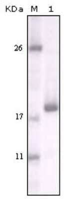 Western Blot: DDR2 Antibody (3B11E4) [NBP1-28883] - Analysis using DDR2 mouse mAb against truncated DDR2 recombinant protein.