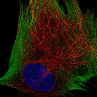 Immunocytochemistry/Immunofluorescence: DDR2 Antibody [NBP2-56485] - Staining of human cell line BJ shows localization to actin filaments. Antibody staining is shown in green. 