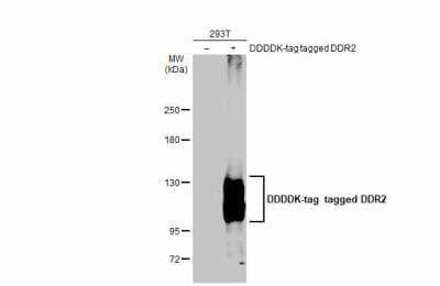 Western Blot: DDR2 Antibody [NBP2-14926] - Non-transfected (-) and transfected (+) 293T whole cell extracts (30 ug) were separated by 5% SDS-PAGE, and the membrane was blotted with DDR2 antibody diluted at 1:3000.