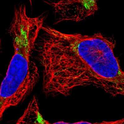 Immunocytochemistry/Immunofluorescence: DDT Antibody [NBP2-13904] - Immunofluorescent staining of human cell line U-2 OS shows localization to mitochondria.