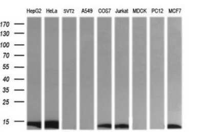 Western Blot: DDT Antibody (OTI1H3) - Azide and BSA Free [NBP2-70562] - Analysis of extracts (35ug) from 9 different cell lines by using DDT monoclonal antibody (HepG2: human; HeLa: human; SVT2: mouse; A549: human; COS7: monkey; Jurkat: human; MDCK: canine; PC12: rat; MCF7: human).