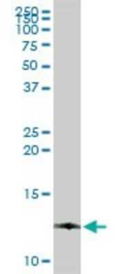 Western Blot: DDT Antibody [H00001652-D01P] - Analysis of DDT expression in human spleen.