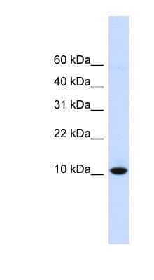 Western Blot: DDT Antibody [NBP1-53202] - Titration: 0.2-1 ug/ml, Positive Control: Human Liver.