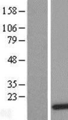 Western Blot: DDT Overexpression Lysate (Adult Normal) [NBL1-09779] Left-Empty vector transfected control cell lysate (HEK293 cell lysate); Right -Over-expression Lysate for DDT.