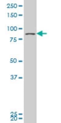 Western Blot: DDX1 Antibody [H00001653-A01] - Analysis of DDX1 expression in U-2 OS (Cat # L022V1).