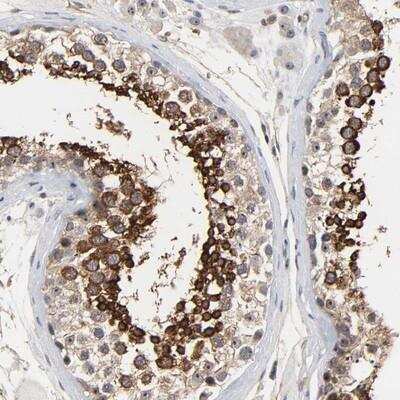 Immunohistochemistry-Paraffin DDX10 Antibody