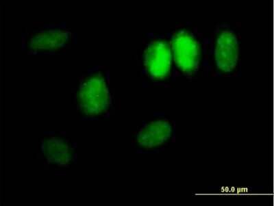 Immunocytochemistry/Immunofluorescence: DDX11 Antibody [H00001663-B01P] - Analysis of purified antibody to DDX11 on HeLa cell. (antibody concentration 10 ug/ml)