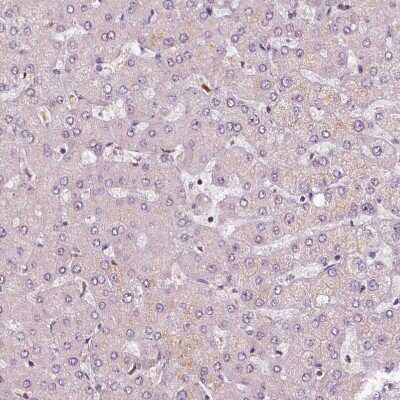 Immunohistochemistry-Paraffin: DDX11 Antibody [NBP2-38060] - Staining of human liver shows no positivity in hepatocytes as expected.