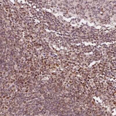 Immunohistochemistry-Paraffin: DDX11 Antibody [NBP2-38060] - Staining of human lymph node shows moderate nuclear positivity in non-germinal center cells.