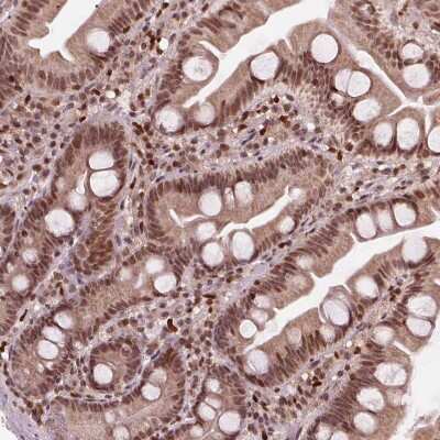 Immunohistochemistry-Paraffin: DDX11 Antibody [NBP2-38060] - Staining of human small intestine shows strong nuclear positivity in lymphoid and glandular cells.