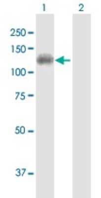 Western Blot: DDX11 Antibody [H00001663-B01P] - Analysis of DDX11 expression in transfected 293T cell line by DDX11 polyclonal antibody.  Lane 1: DDX11 transfected lysate(106.7 KDa). Lane 2: Non-transfected lysate.