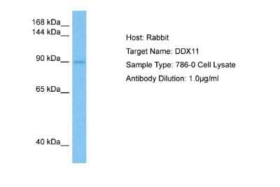 Western Blot: DDX11 Antibody [NBP2-87260] - Host: Rabbit. Target Name: DDX11. Sample Tissue: Human 786-0 Whole Cell lysates. Antibody Dilution: 1ug/ml