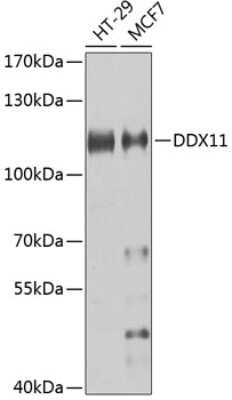 Western Blot: DDX11 Antibody [NBP2-92510] - Analysis of extracts of various cell lines, using DDX11 at 1:1000 dilution.Secondary antibody: HRP Goat Anti-Rabbit IgG (H+L) at 1:10000 dilution.Lysates/proteins: 25ug per lane.Blocking buffer: 3% nonfat dry milk in TBST.Detection: ECL Basic Kit .Exposure time: 20s.