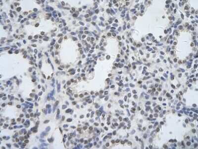 Immunohistochemistry-Paraffin: DDX17 Antibody [NBP2-87262] - Paraffin Embedded Tissue: Human alveolar cell. Cellular Data: Epithelial cells of renal tubule. Antibody Concentration: 4.0-8.0 ug/ml. Magnification: 400X