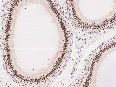 Immunohistochemistry-Paraffin: DDX17 Antibody [NBP3-06322] - Immunochemical staining of human DDX17 in human epididymis with rabbit polyclonal antibody at 1:200 dilution, formalin-fixed paraffin embedded sections.