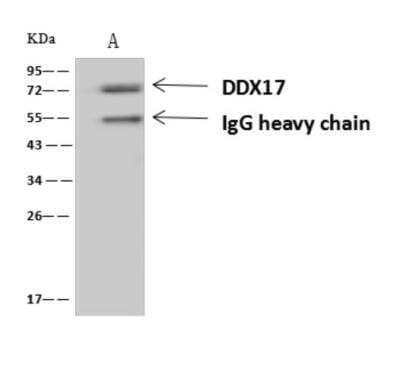 Immunoprecipitation: DDX17 Antibody [NBP3-06322] - DDX17 was immunoprecipitated using:Lane A:0.5 mg HeLa Whole Cell Lysate4 uL anti-DDX17 rabbit polyclonal antibody and 60 ug of Immunomagnetic beads Protein AG. Primary antibody:Anti-DDX17 rabbit polyclonal antibody,at 1:100 dilution Secondary antibody:Goat Anti-Rabbit IgG (H+L) HRP at 110000 dilutionDeveloped using the ECL technique.Performed under reducing conditions.Predicted band size: 72 kDaObserved band size :72 kDa
