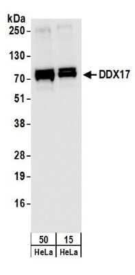 Western Blot DDX17 Antibody