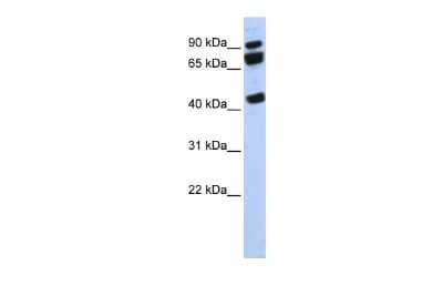 Western Blot: DDX17 Antibody [NBP2-87261] - WB Suggested Anti-DDX17 Antibody Titration: 0.2-1 ug/ml. ELISA Titer: 1:312500. Positive Control: 721_B cell lysateDDX17 is strongly supported by BioGPS gene expression data to be expressed in Human 721_B cells