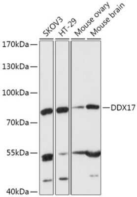 Western Blot: DDX17 Antibody [NBP2-92878] - Analysis of extracts of various cell lines, using DDX17 at 1:1000 dilution.Secondary antibody: HRP Goat Anti-Rabbit IgG (H+L) at 1:10000 dilution.Lysates/proteins: 25ug per lane.Blocking buffer: 3% nonfat dry milk in TBST.Detection: ECL Basic Kit .Exposure time: 5min.