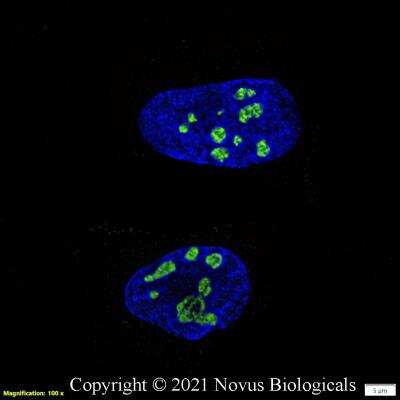 Immunocytochemistry/Immunofluorescence: DDX21 Antibody [Alexa Fluor® 488] [NB100-1718AF488] - HeLa cells were fixed in 4% paraformaldehyde for 10 minutes and permeabilized in 0.05% Triton X-100 in PBS for 5 minutes. The cells were incubated with DDX21 Antibody conjugated to Alexa Fluor 488 (NB100-1718AF488) at 5 ug/ml for 1 hour at room temperature.  Nuclei were counterstained with DAPI (Blue).  Cells were imaged using a 100X objective and digitally deconvolved.