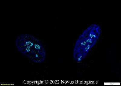 Immunocytochemistry/Immunofluorescence: DDX21 Antibody [Alexa Fluor® 647] [NB100-1718AF647] - HeLa cells were fixed in 4% paraformaldehyde for 10 minutes and permeabilized in 0.05% Triton X-100 in PBS for 5 minutes. The cells were incubated with DDX21 Antibody conjugated to Alexa Fluor 647 (NB100-1718AF647) at 2 ug/ml for 1 hour at room temperature.  Nuclei were counterstained with DAPI (Blue).  Cells were imaged using a 100X objective and digitally deconvolved.