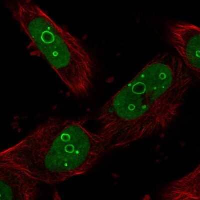 Immunocytochemistry/Immunofluorescence: DDX21 Antibody [NBP1-83310] - Staining of human cell line U-251 MG shows localization to nucleus & nucleoli. Antibody staining shown in green.