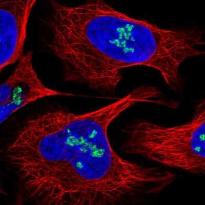 Immunocytochemistry/Immunofluorescence: DDX21 Antibody [NBP2-38311] - Staining of human cell line U-2 OS shows localization to nucleoli. Antibody staining is shown in green.