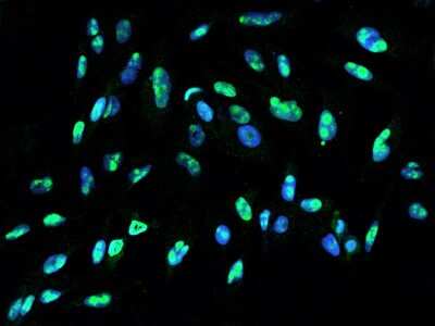 Immunocytochemistry/Immunofluorescence: DDX21 Antibody [NBP2-97537] - Immunofluorescence staining of DDX21 in U251MG cells. Cells were fixed with 4% PFA, permeabilzed with 0.1% Triton X-100 in PBS, blocked with 10% serum, and incubated with rabbit anti-Human DDX21 polyclonal antibody (dilution ratio 1:200) at 4C overnight. Then cells were stained with the Alexa Fluor(R)488-conjugated Goat Anti-rabbit IgG secondary antibody (green) and counterstained with DAPI (blue).Positive staining was localized to Nucleus.