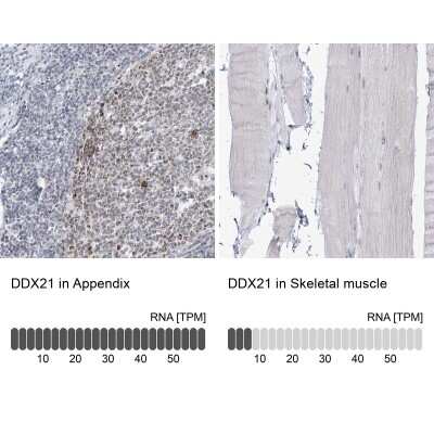 Immunohistochemistry-Paraffin: DDX21 Antibody [NBP1-83310] - Analysis in human appendix and skeletal muscle tissues using NBP1-83310 antibody. Corresponding DDX21 RNA-seq data are presented for the same tissues.