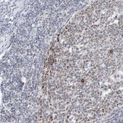 Immunohistochemistry-Paraffin: DDX21 Antibody [NBP1-83310] - Staining of human appendix shows strong positivity in nucleoli in lymphoid tissue.