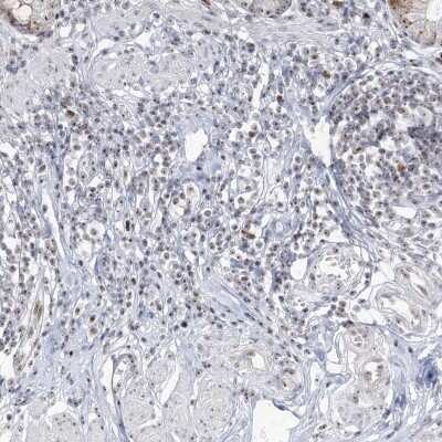 Immunohistochemistry-Paraffin: DDX21 Antibody [NBP2-38311] - Staining of human appendix shows high expression.