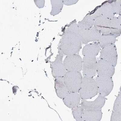 Immunohistochemistry-Paraffin: DDX21 Antibody [NBP2-38311] - Staining of human skeletal muscle shows low expression as expected.