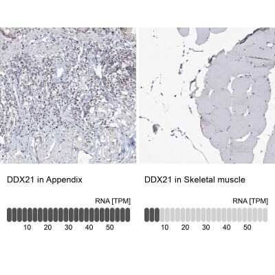 <b>Orthogonal Strategies Validation. </b>Immunohistochemistry-Paraffin: DDX21 Antibody [NBP2-38311] - Staining in human appendix and skeletal muscle tissues using anti-DDX21 antibody. Corresponding DDX21 RNA-seq data are presented for the same tissues.