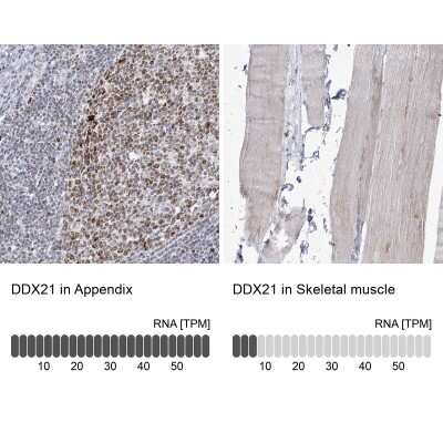 Immunohistochemistry-Paraffin: DDX21 Antibody [NBP2-38311] - Analysis in human appendix and skeletal muscle tissues using NBP2-38311 antibody. Corresponding DDX21 RNA-seq data are presented for the same tissues.