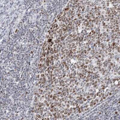 Immunohistochemistry-Paraffin: DDX21 Antibody [NBP2-38311] - Staining of human appendix shows strong positivity in nucleoli in lymphoid tissue.