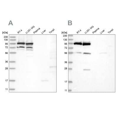 Western Blot: DDX21 Antibody [NBP2-38311] - Analysis using Anti-DDX21 antibody NBP2-38311 (A) shows similar pattern to independent antibody NBP1-83310 (B).