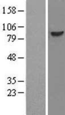 Western Blot: DDX21 Overexpression Lysate (Adult Normal) [NBL1-09787] Left-Empty vector transfected control cell lysate (HEK293 cell lysate); Right -Over-expression Lysate for DDX21.