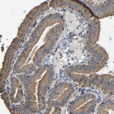 Immunohistochemistry-Paraffin DDX26B Antibody