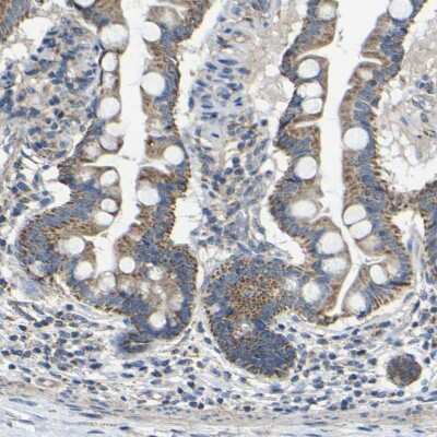 Immunohistochemistry-Paraffin DDX26B Antibody