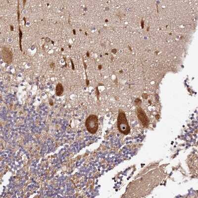 Immunohistochemistry-Paraffin DDX27 Antibody