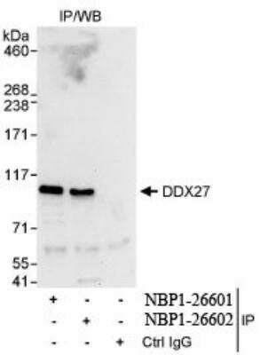 Immunoprecipitation: DDX27 Antibody [NBP1-26601] - Whole cell lysate from HeLa cells. Antibodies: Affinity purified rabbit used for IP at 10 mcg/mg lysate.