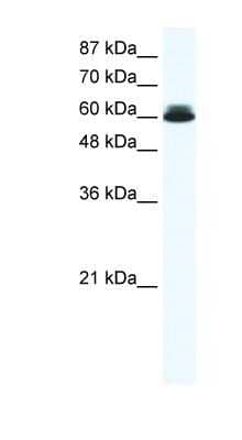 Western Blot: DDX27 Antibody [NBP1-57345] - Titration: 0.625ug/ml, Positive Control: HepG2 cell lysate.