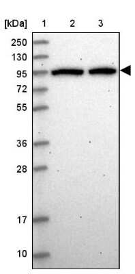 Western Blot DDX27 Antibody