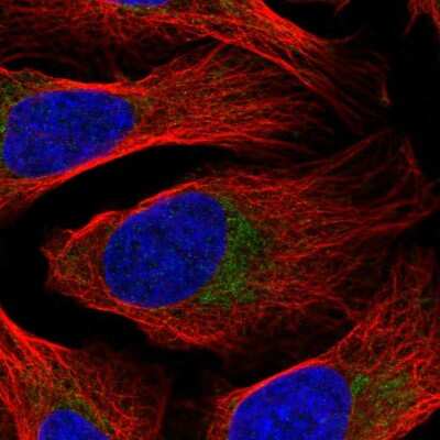 Immunocytochemistry/Immunofluorescence: DDX28 Antibody [NBP2-58209] - Staining of human cell line U-2 OS shows localization to mitochondria.