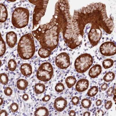 Immunohistochemistry-Paraffin: DDX28 Antibody [NBP1-83757] - Staining of human stomach, upper shows strong cytoplasmic positivity in glandular cells.