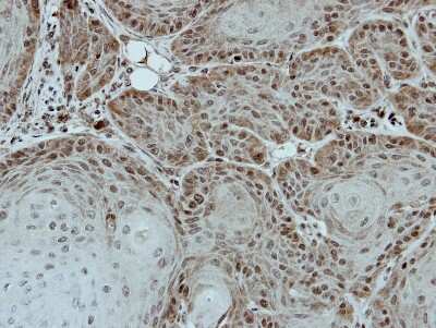 Immunohistochemistry-Paraffin: DDX28 Antibody [NBP2-16131] - Immunohistochemical analysis of paraffin-embedded Cal27 xenograft, using antibody at 1:500 dilution.