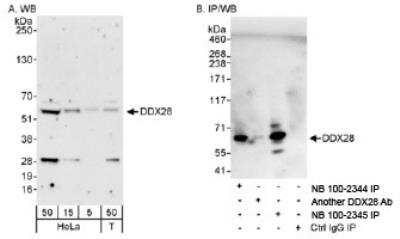 Western Blot: DDX28 Antibody [NB100-2345] - Detection of Human DDX28 on HeLa whole cell lysate. DDX28 was also immunoprecipitated using rabbit  anti-DDX28 antibody NB100-2344.