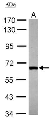 Western Blot: DDX28 Antibody [NBP2-16131] - Sample (30 ug of whole cell lysate) A:IMR32 7. 5% SDS PAGE gel, diluted at 1:1000.